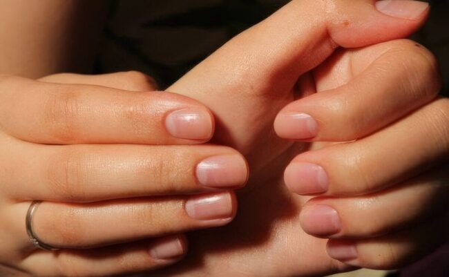 Cold Nails